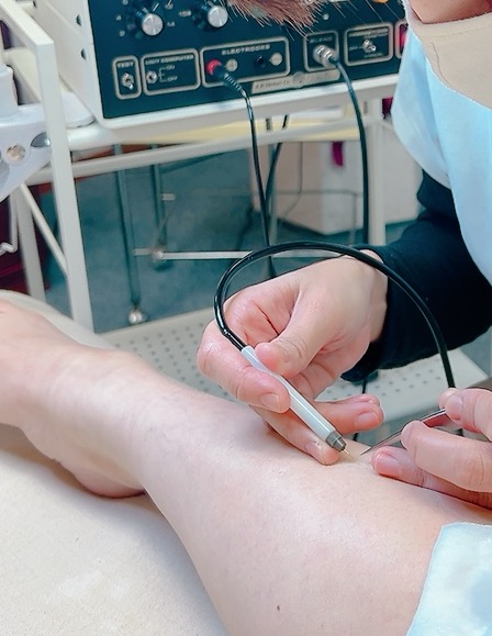 産毛白髪硬毛化にも対応出来る美容電気脱毛