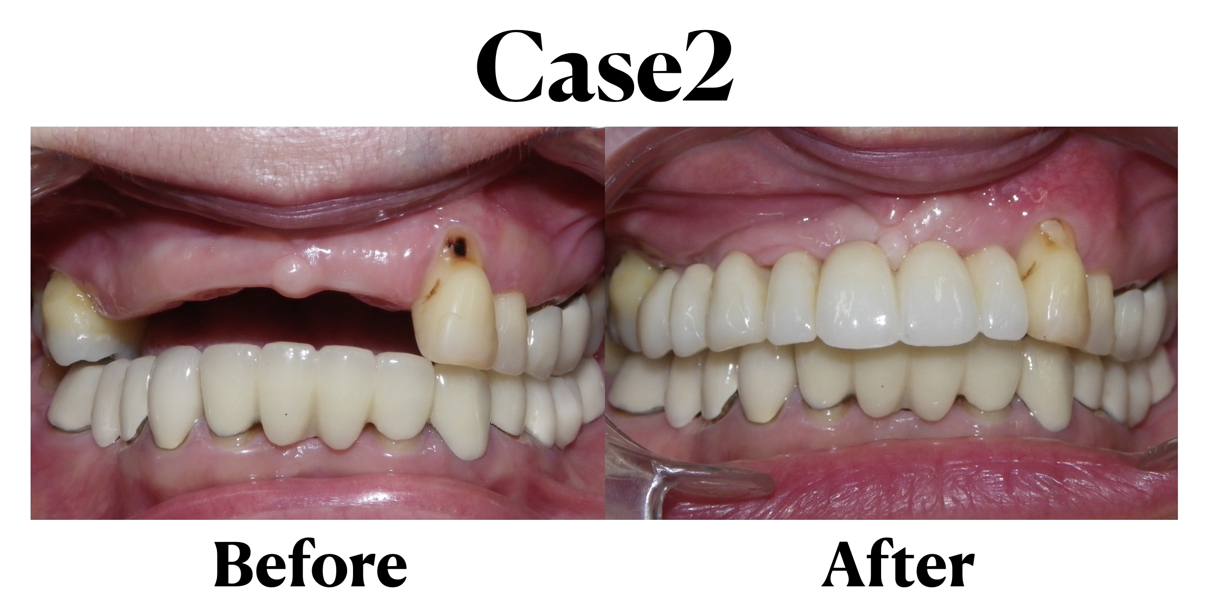 医療法人　堅心会　ヒロデンタルクリニックのサブ写真１