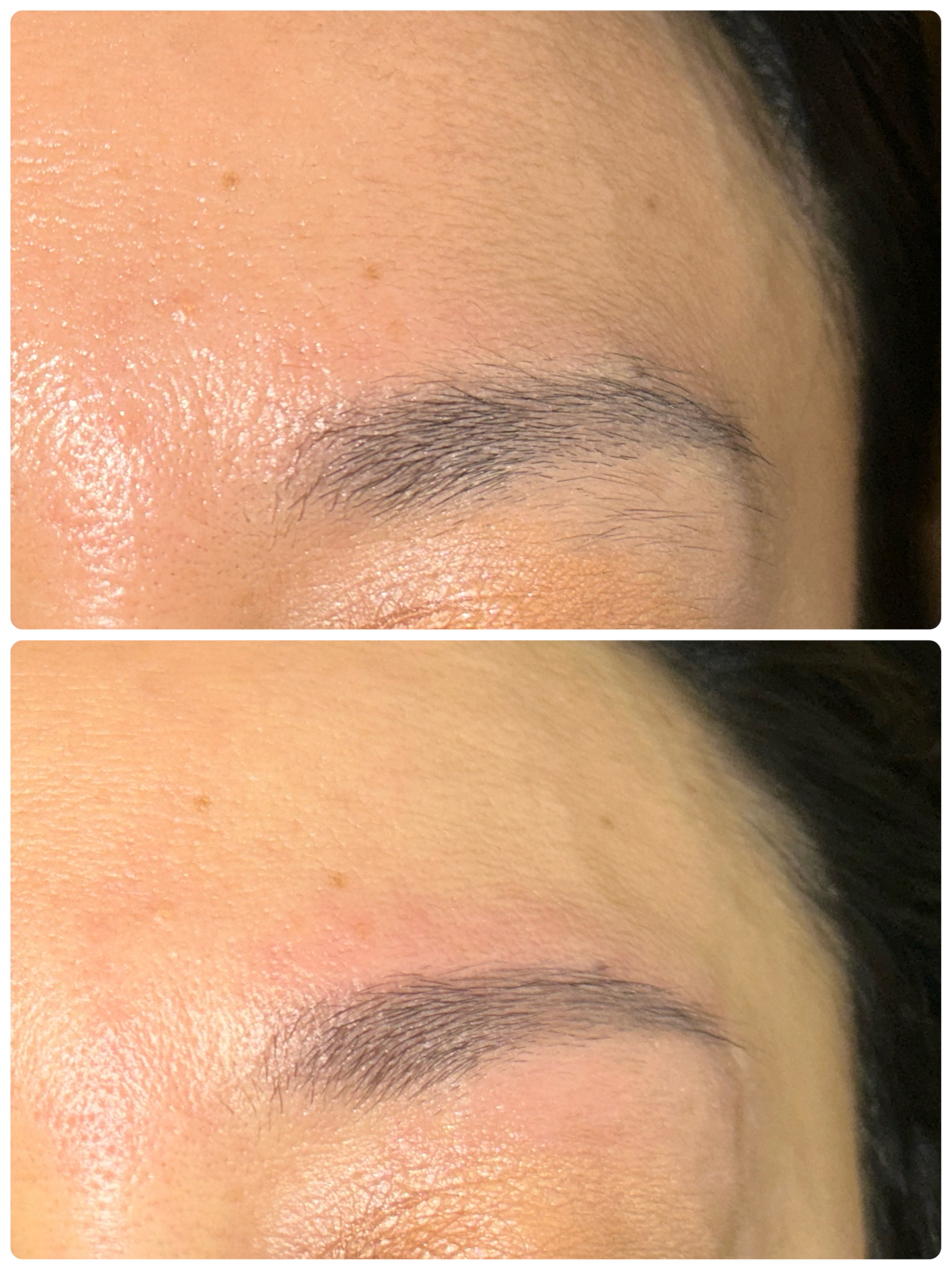 エステティックルームALIVIO【白髪・他で抜けなかった毛専門　美容電気美容脱毛】のサブ写真２