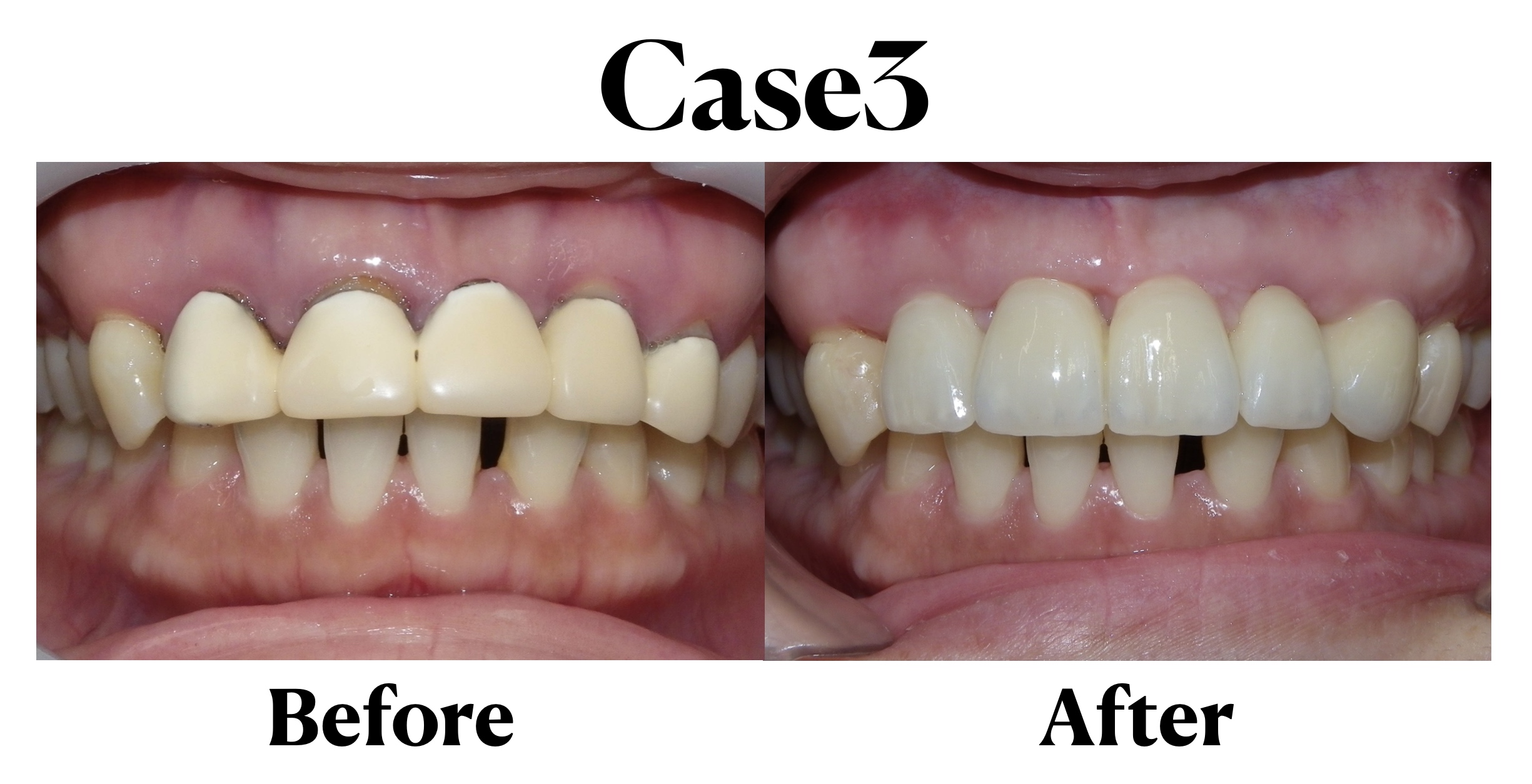 医療法人　堅心会　ヒロデンタルクリニックのサブ写真２